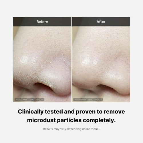Medicube Zero Foam Temizleyici – Derin Gözenek Temizliği